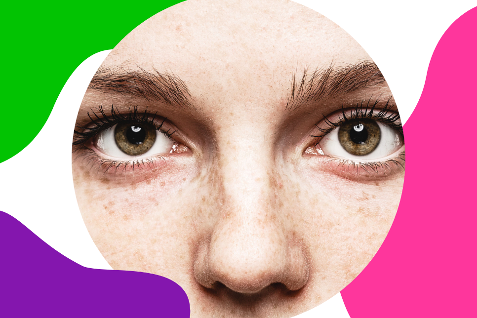 zwei braune Frauenaugen schauen betroffen drein und denken darüber nach, wie es nach der Diagnose einer Schilddrüsenerkrankung weitergeht